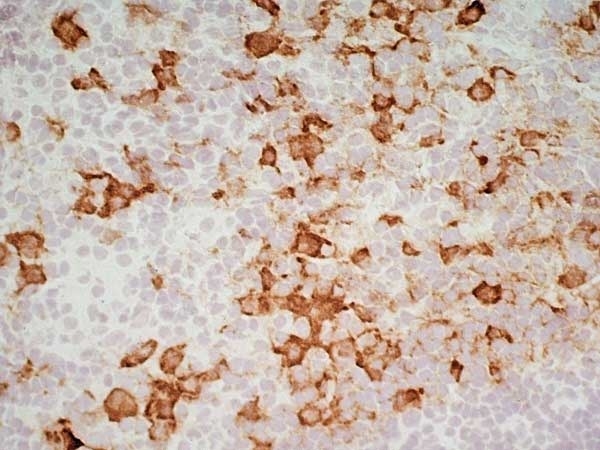 Anti Mouse IgG1 Antibody gallery image 5