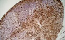 Anti Mouse IgG1 Antibody - 0.5mg gallery image 6