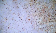  Anti Mouse IgG2a Antibody  gallery image 2