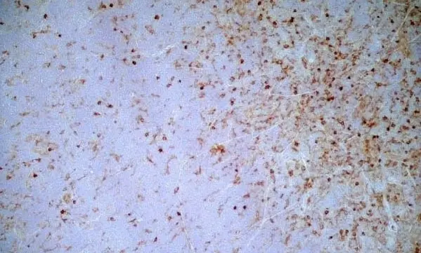  Anti Mouse IgG2a Antibody  gallery image 2