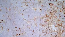 Anti Mouse IgG2a Antibody  gallery image 3