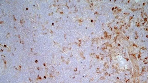  Anti Mouse IgG2a Antibody  gallery image 3