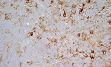  Anti Mouse IgG2a Antibody  gallery image 4