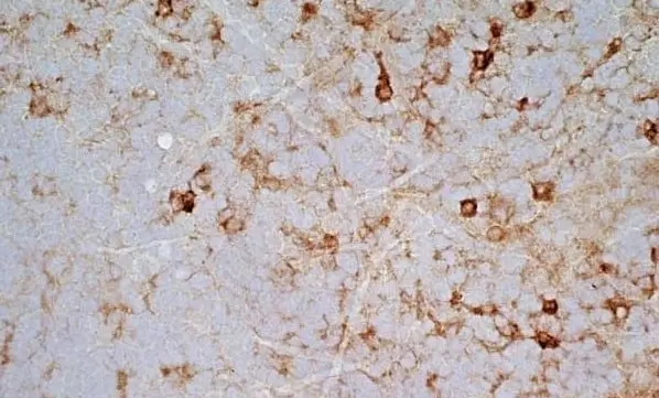  Anti Mouse IgG2a Antibody  gallery image 4