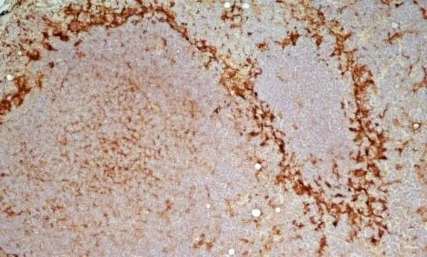  Anti Mouse IgG2a Antibody  gallery image 5