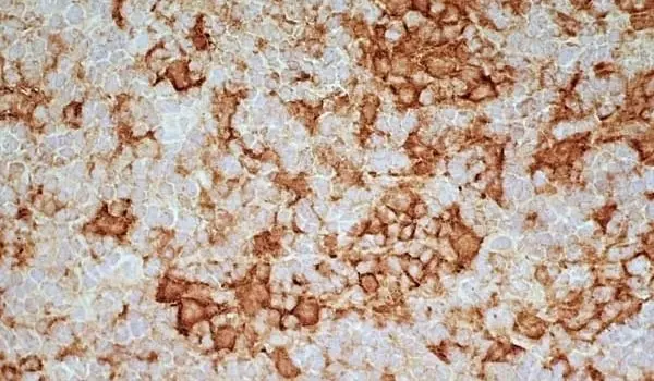  Anti Mouse IgG2a Antibody  gallery image 6