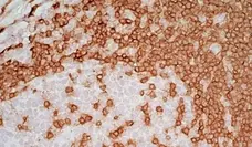  Anti Mouse IgG2a Antibody  gallery image 8