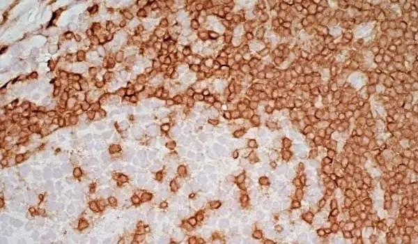  Anti Mouse IgG2a Antibody  gallery image 8