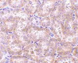 Anti RIP3 Antibody gallery image 2