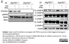 Anti RIP3 Antibody gallery image 3