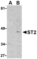 Anti Mouse ST2 (N-Terminal) Antibody gallery image 1