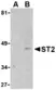 Anti Mouse ST2 (N-Terminal) Antibody thumbnail image 1