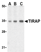 Anti TIRAP Antibody gallery image 1