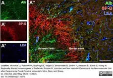 Anti Rat Albumin Antibody gallery image 1