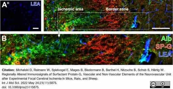 Anti Rat Albumin Antibody gallery image 2