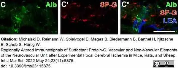 Anti Rat Albumin Antibody gallery image 3