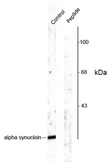 Anti Alpha Synuclein (pSer129) Antibody gallery image 1