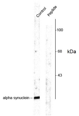Anti Alpha Synuclein (pSer129) Antibody gallery image 1