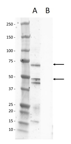 Anti Rat Calcitonin Receptor Antibody gallery image 1