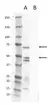 Anti Rat Calcitonin Receptor Antibody thumbnail image 1