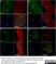 Anti Rat Calcitonin Receptor Antibody thumbnail image 1
