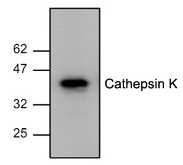 Anti Cathepsin K Antibody gallery image 1