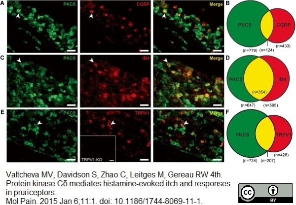 Anti Rat Calcitonin Gene-Related Peptide Antibody gallery image 1