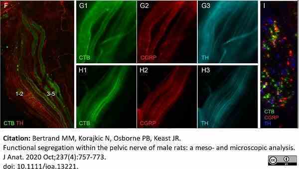 Anti Rat Calcitonin Gene-Related Peptide Antibody gallery image 10