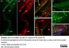 Anti Rat Calcitonin Gene-Related Peptide Antibody gallery image 11