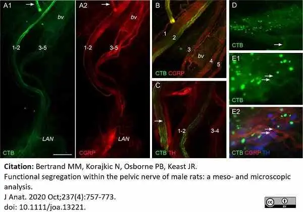 Anti Rat Calcitonin Gene-Related Peptide Antibody gallery image 11