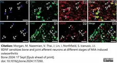 Anti Rat Calcitonin Gene-Related Peptide Antibody gallery image 12