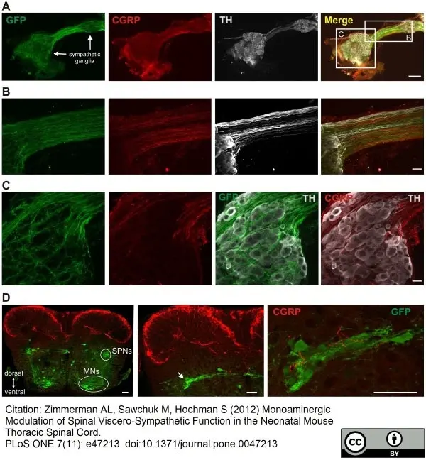Anti Rat Calcitonin Gene-Related Peptide Antibody gallery image 3