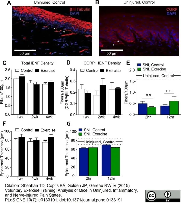 Anti Rat Calcitonin Gene-Related Peptide Antibody gallery image 4