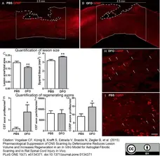 Anti Rat Calcitonin Gene-Related Peptide Antibody gallery image 5