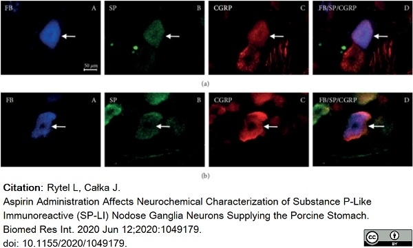 Anti Rat Calcitonin Gene-Related Peptide Antibody gallery image 6