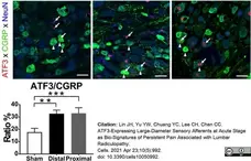 Anti Rat Calcitonin Gene-Related Peptide Antibody gallery image 7