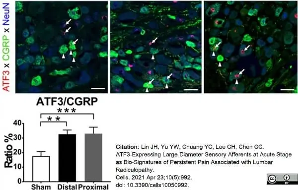 Anti Rat Calcitonin Gene-Related Peptide Antibody gallery image 7