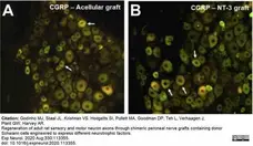 Anti Rat Calcitonin Gene-Related Peptide Antibody gallery image 9