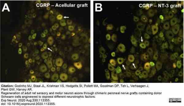 Anti Rat Calcitonin Gene-Related Peptide Antibody gallery image 9