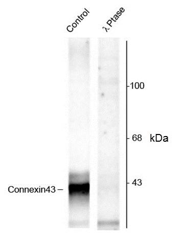 Anti Connexin 43 (pSer368) Antibody gallery image 1