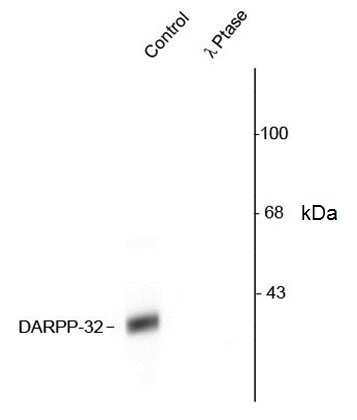 Anti Darpp-32 (pThr34) Antibody gallery image 1