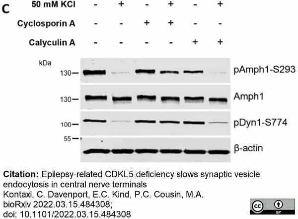 Anti Dynamin (pSer774) Antibody gallery image 2