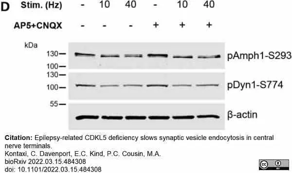 Anti Dynamin (pSer774) Antibody gallery image 3