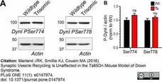 Anti Dynamin (pSer774) Antibody gallery image 4