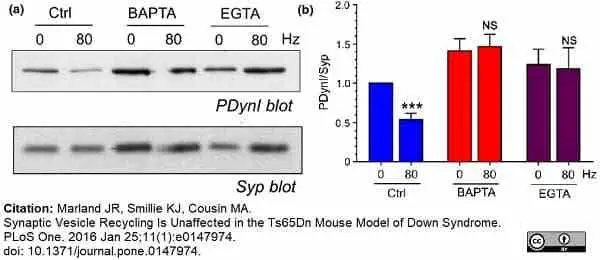 Anti Dynamin (pSer774) Antibody gallery image 6