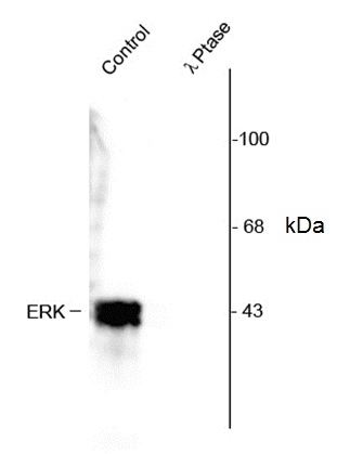 Anti ERK / MAPK (pThr202/pTyr204) Antibody gallery image 1