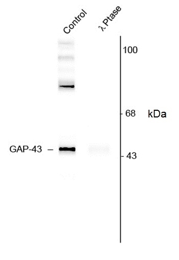 Anti GAP43 (pSer41) Antibody gallery image 1