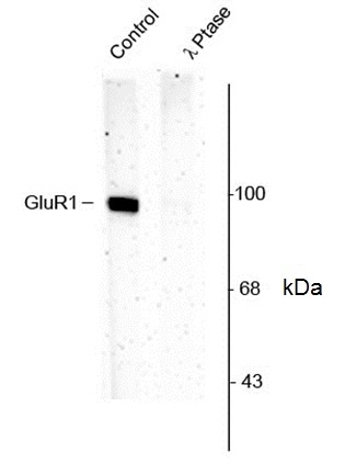 Anti GluR1 (pSer831) Antibody gallery image 1