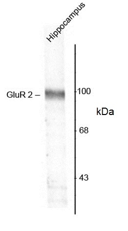 Anti GluR2 Antibody gallery image 1