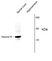 Anti Glycine Receptor Alpha 1/2 (N-Terminal) Antibody thumbnail image 1